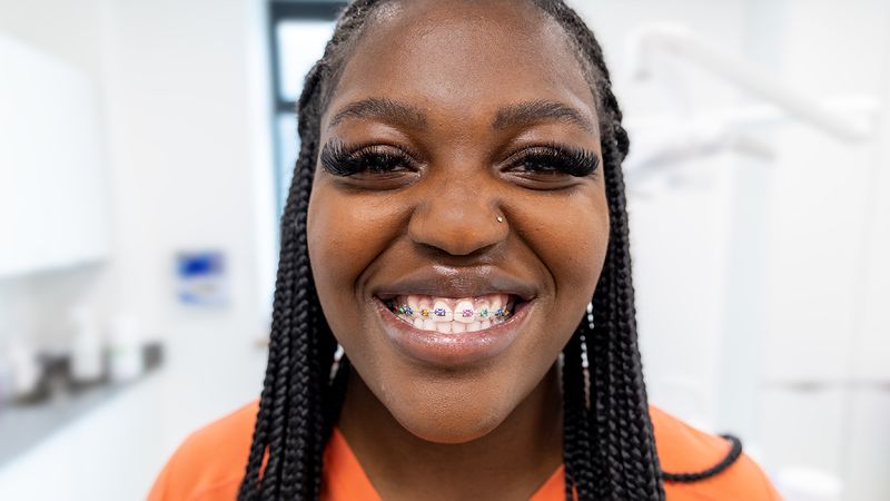 Teeth braces sale