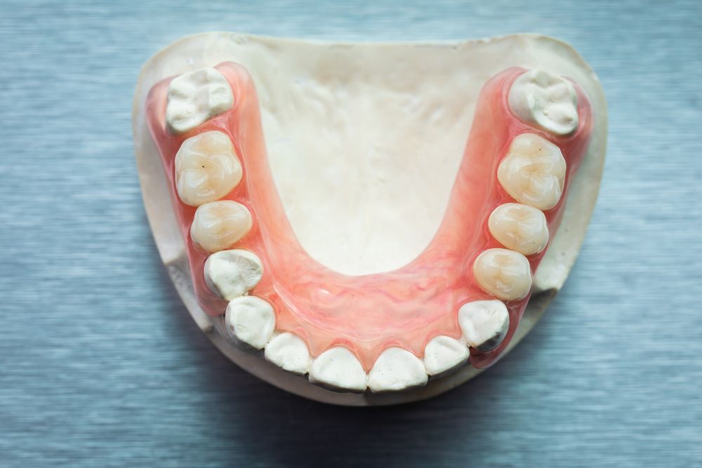What Material Are Dental Implants Made Of? 3Dental