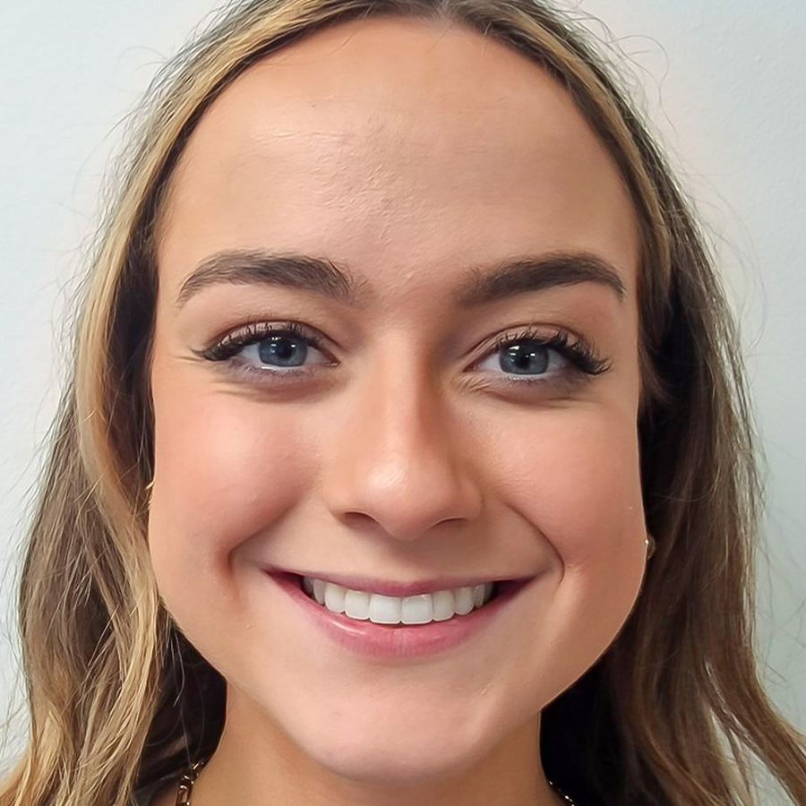 Smile Gallery | Before & Afters | Smile Makeover // 3Dental