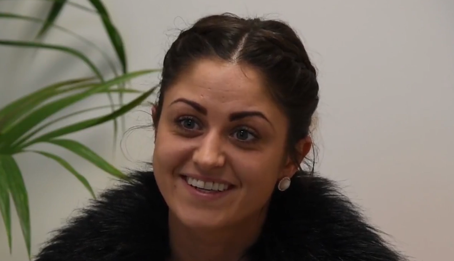 Do 6 Month Braces Actually Work? Orthodontics // 3Dental